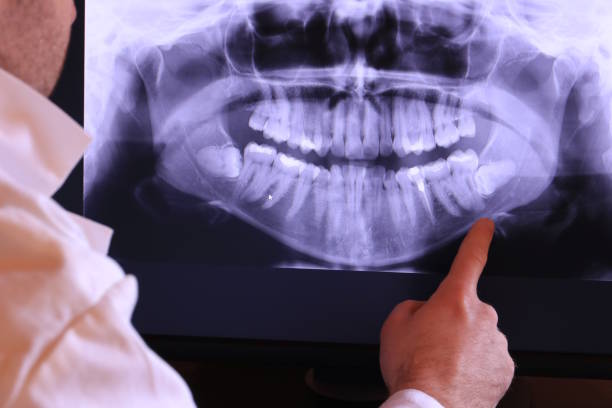 Best Emergency Gum Treatment in Bessemer, AL